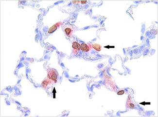 Biodistribution study Detection of human mesenchymal stem cells (hMSCs) in rats